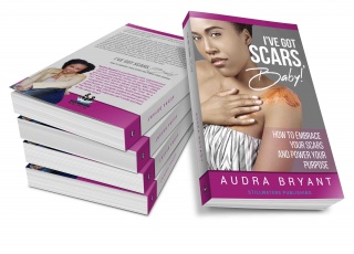 I've Got Scars Baby! How to Embrace Your Scars and Power Your Purpose By: Audra Bryant